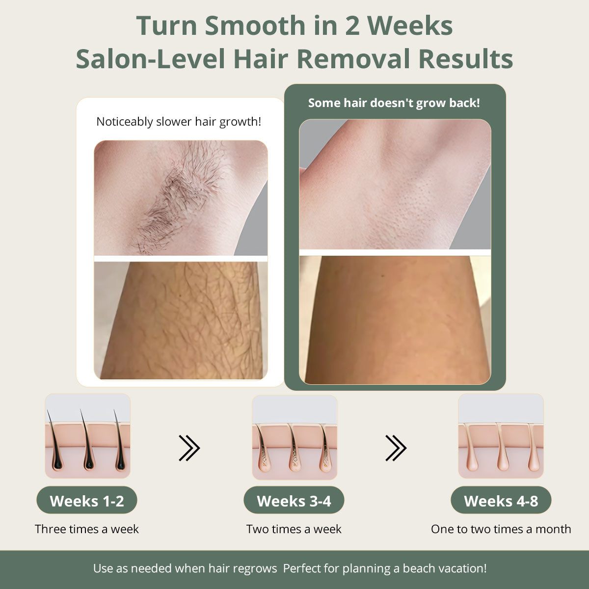 IPL Laser Hair Removal with Cooling System