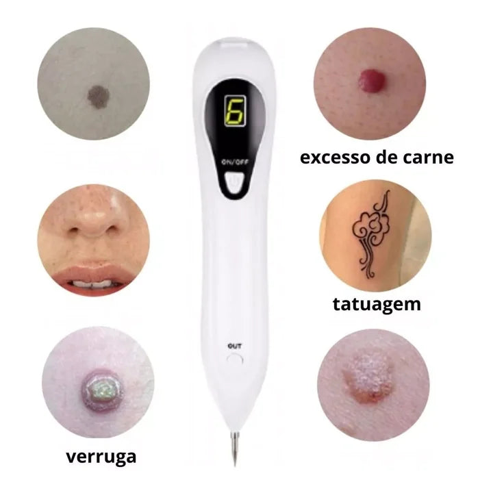 Mole removal pen