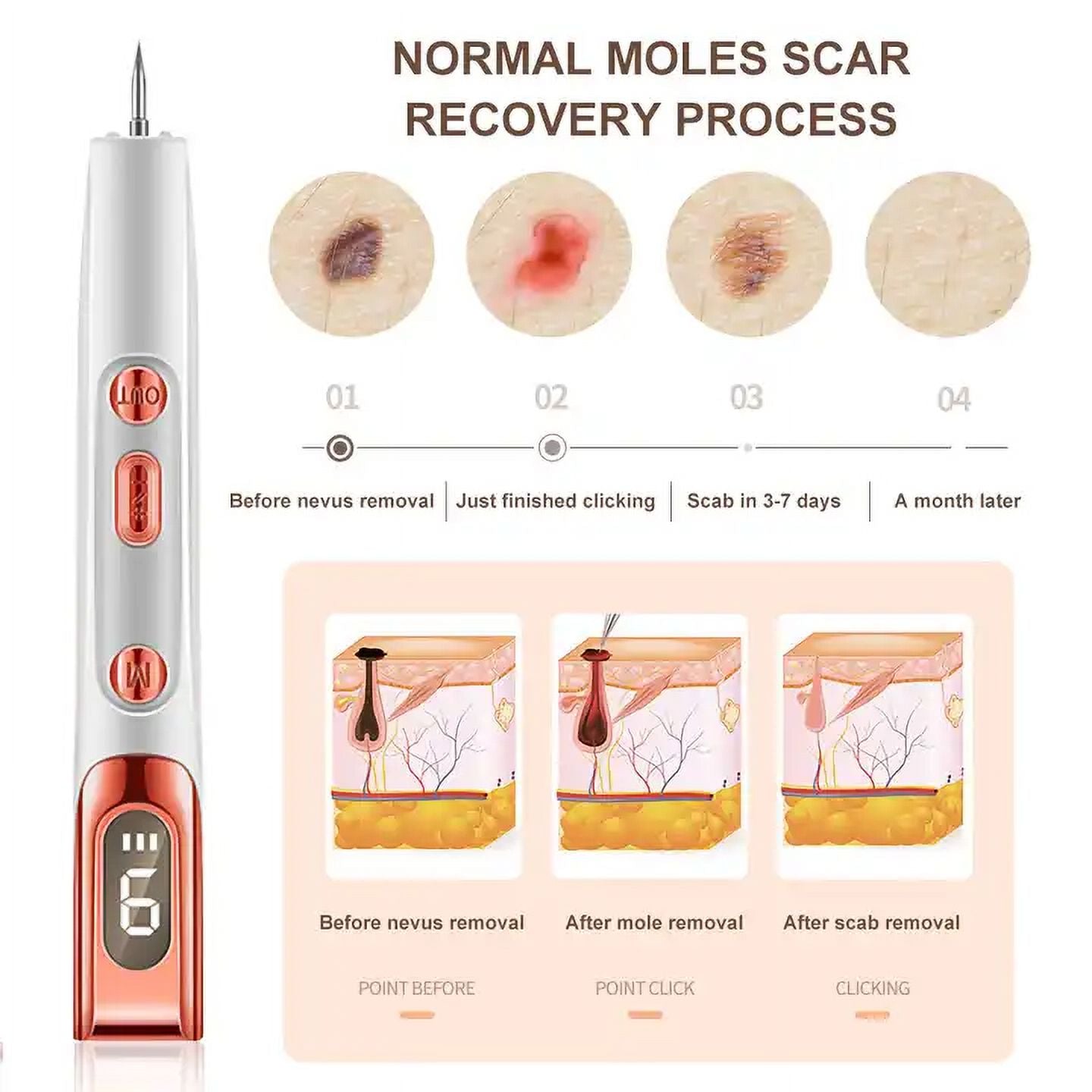 Portable Beauty Pen with 9 Modes Adjustment