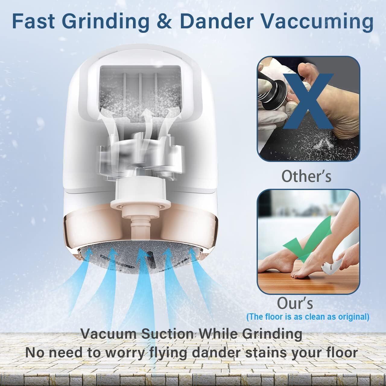 Electric Callus Remover for Feet