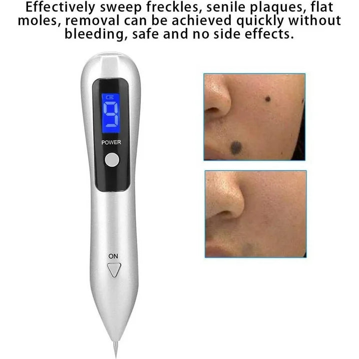 Mole removal pen