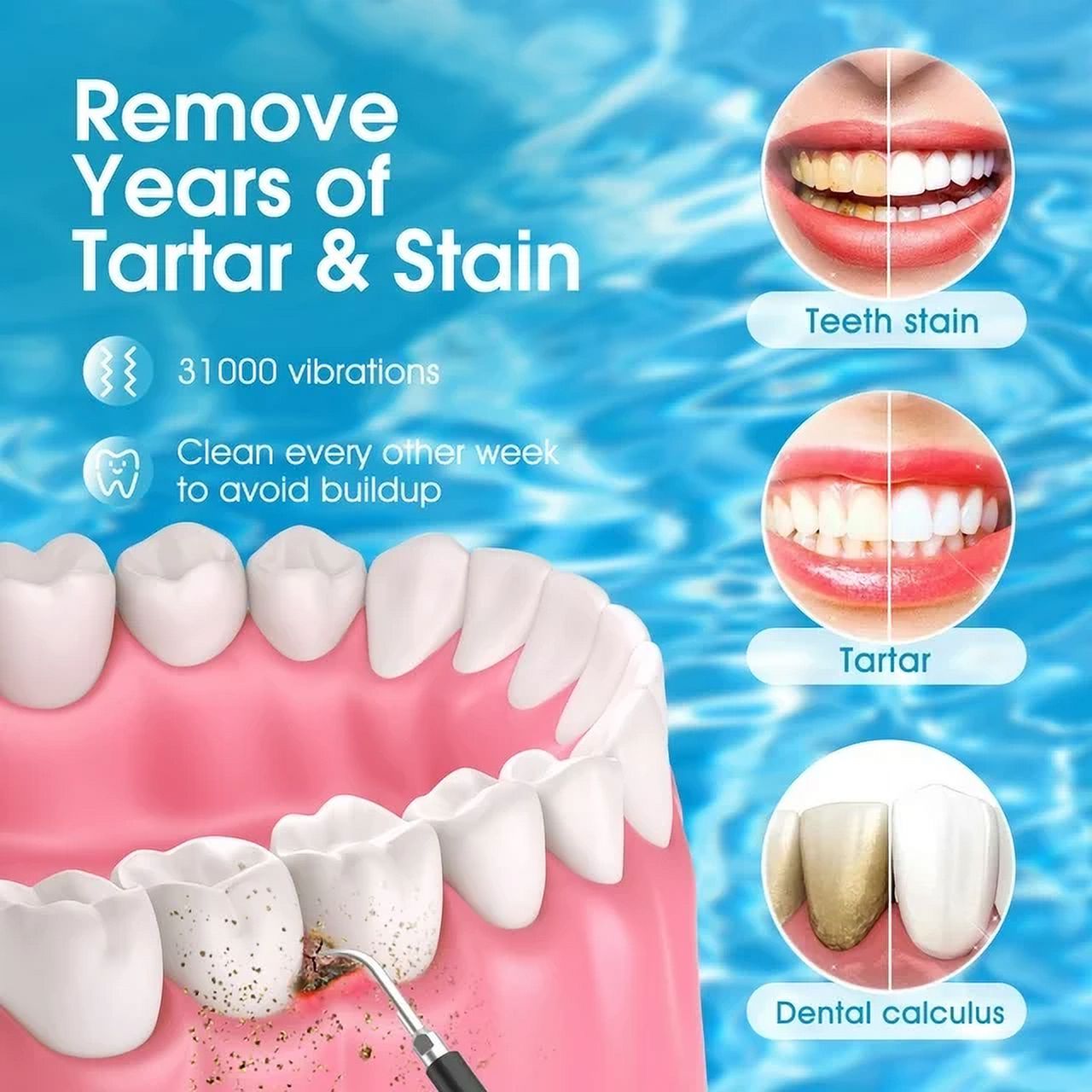 Plaque remover for teeth