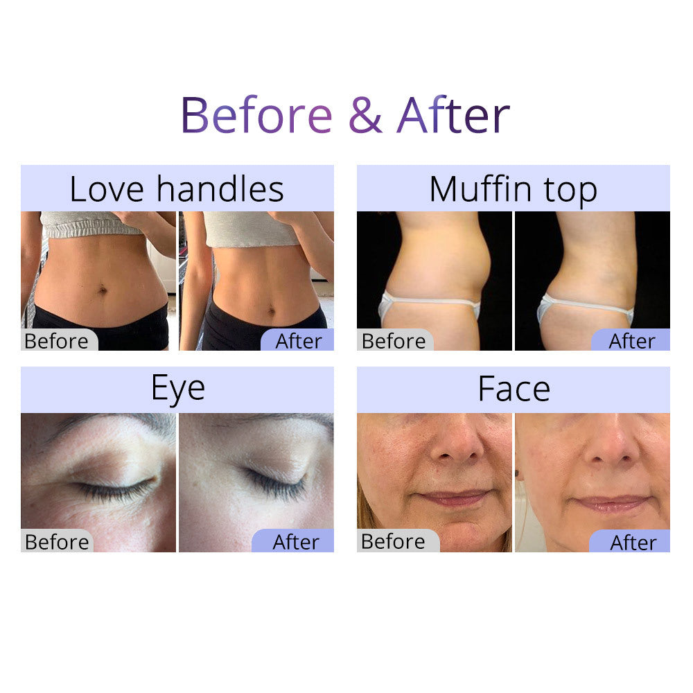 11 in 1 Body Beauty Machine