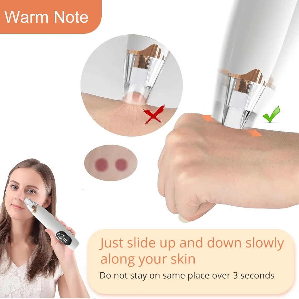 Blackhead Remover Vacuum Kit
