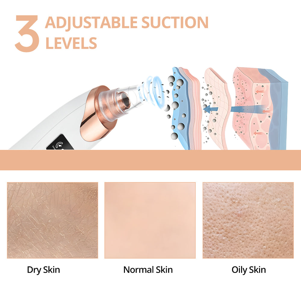 Blackhead Remover Pore Vacuum