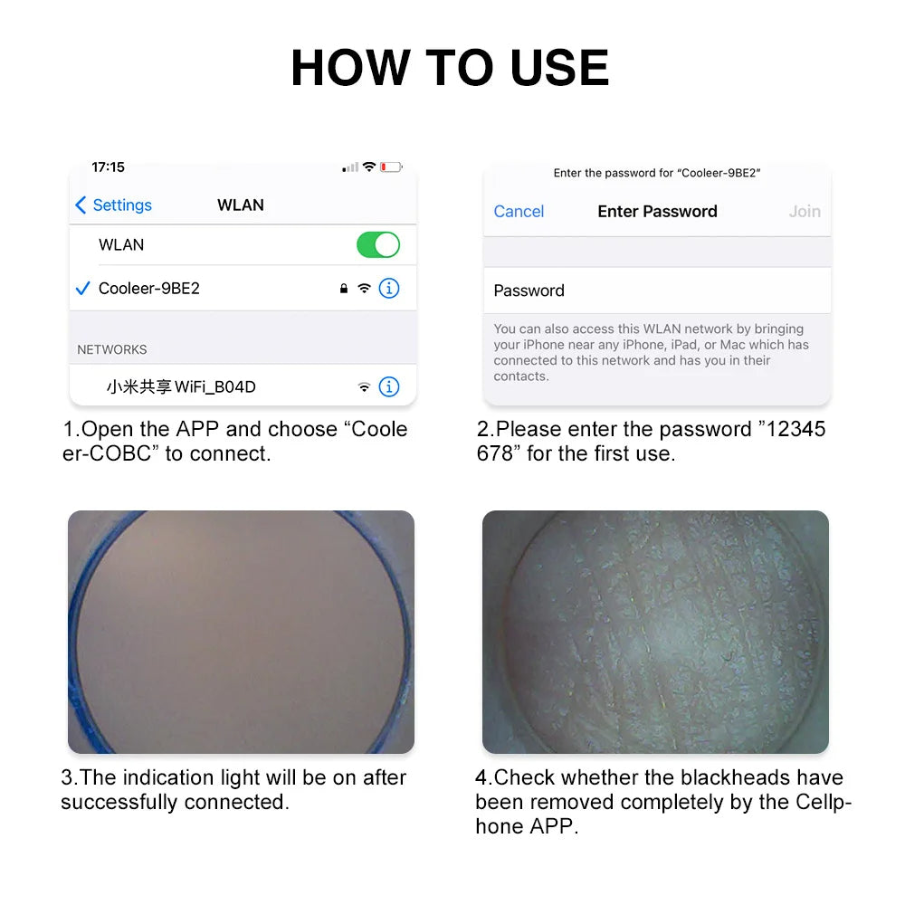 Blackhead Remover Vacuum with Camera