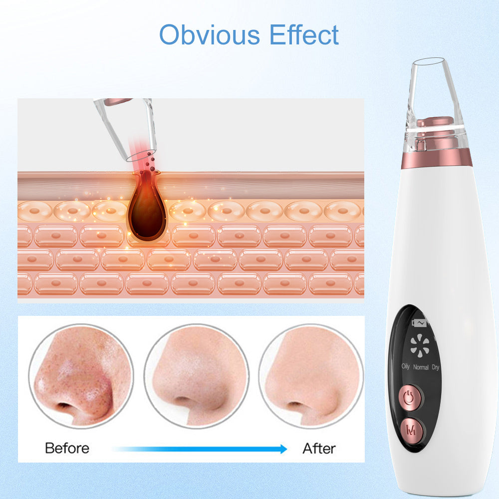 Blackhead Remover Vacuum Kit
