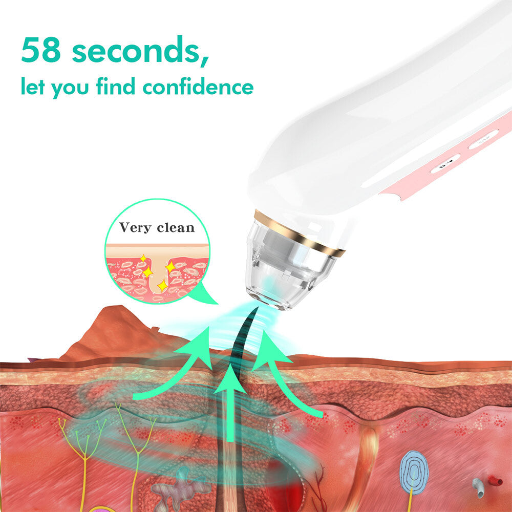 5 Modes Blackhead Remover Vacuum with Camera