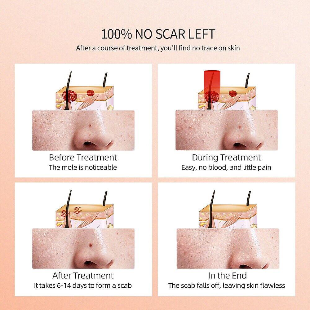 Portable Beauty Pen with 9 Modes Adjustment
