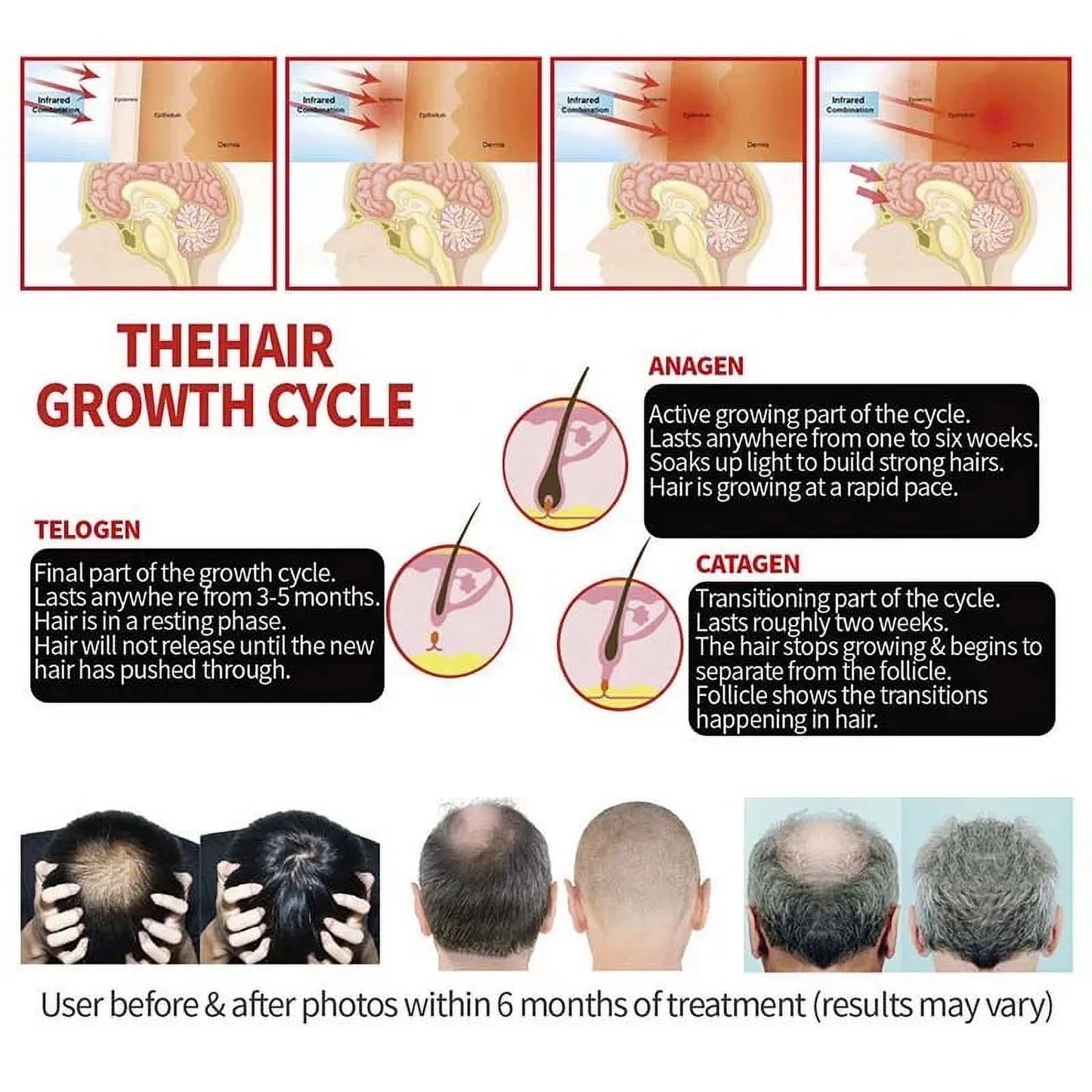 Hair Growth Device