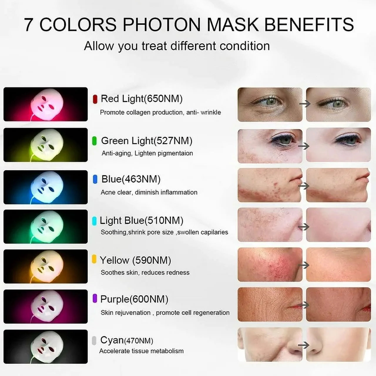 Aristorm LED Face Mask Light Therapy Skin Beauty Machine