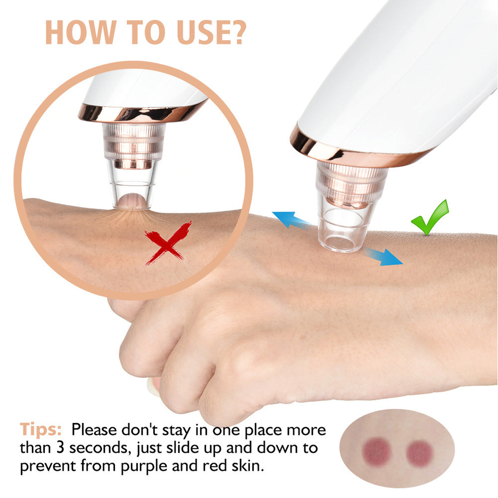 Blackhead Remover Pore Vacuum