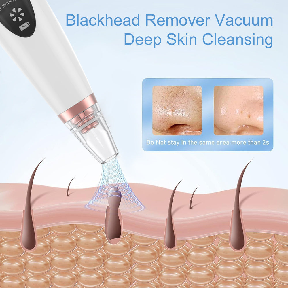 Blackhead Remover Vacuum Kit