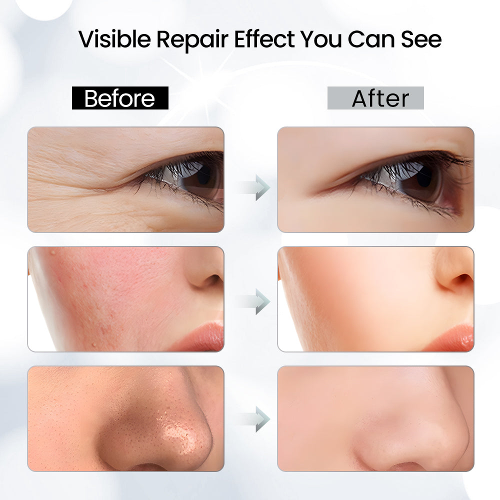 Led Face Mask Light Therapy