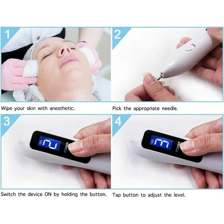 Mole removal pen